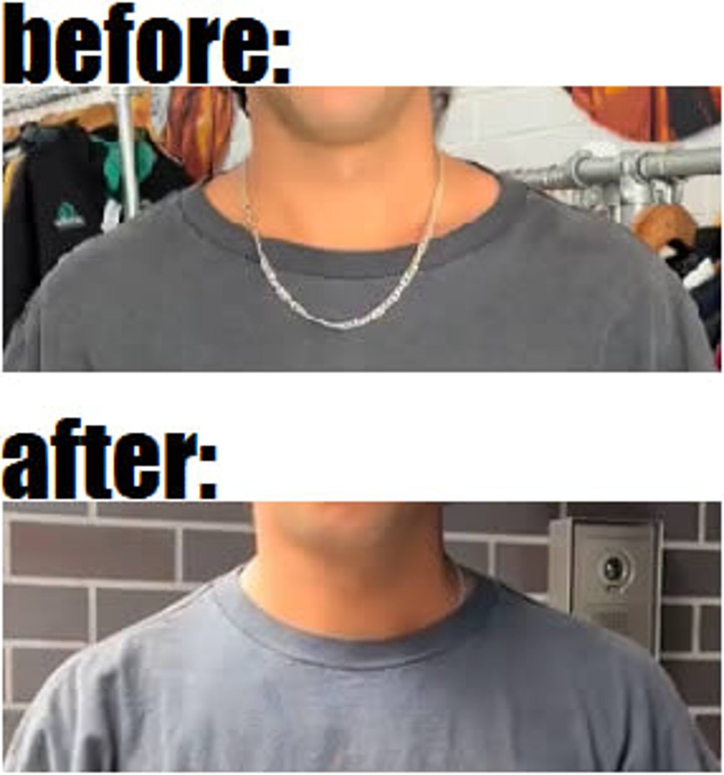 gripTEES: gripFIT Bacon-Neck Collar Repair Kit